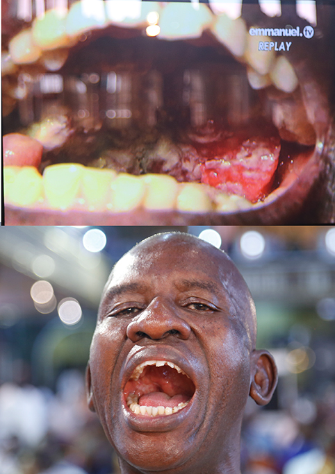 BOCA DEL SEÑOR OMOTOSHO ANTES Y DESPUÉS