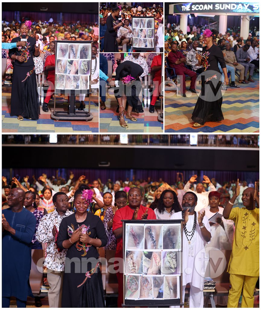 The SCOAN Sunday Service: Testimonies (October 4, 2026)